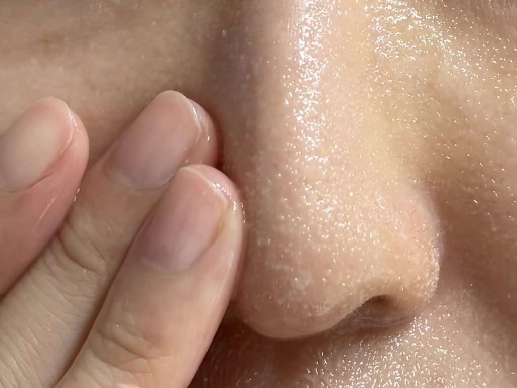 Massaging Manyo cleansing oil on dry face and nostrils to dissolve sebaceous filaments and blackheads.